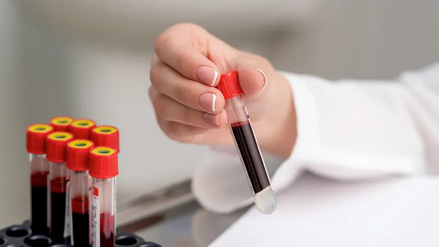 crp ve sedimantasyon değerleri